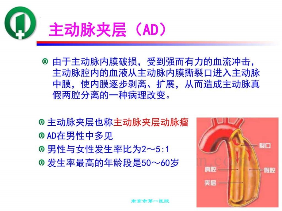 1例主动脉夹层术后患者并发肺不张的护理图文.ppt.ppt_第3页