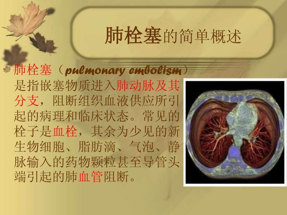 肺栓塞的治疗方案.ppt.ppt_第2页