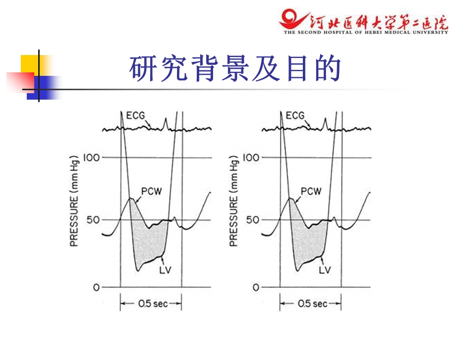 二尖瓣跨瓣压差测量方法的评价及临床应用文档资料.ppt_第2页