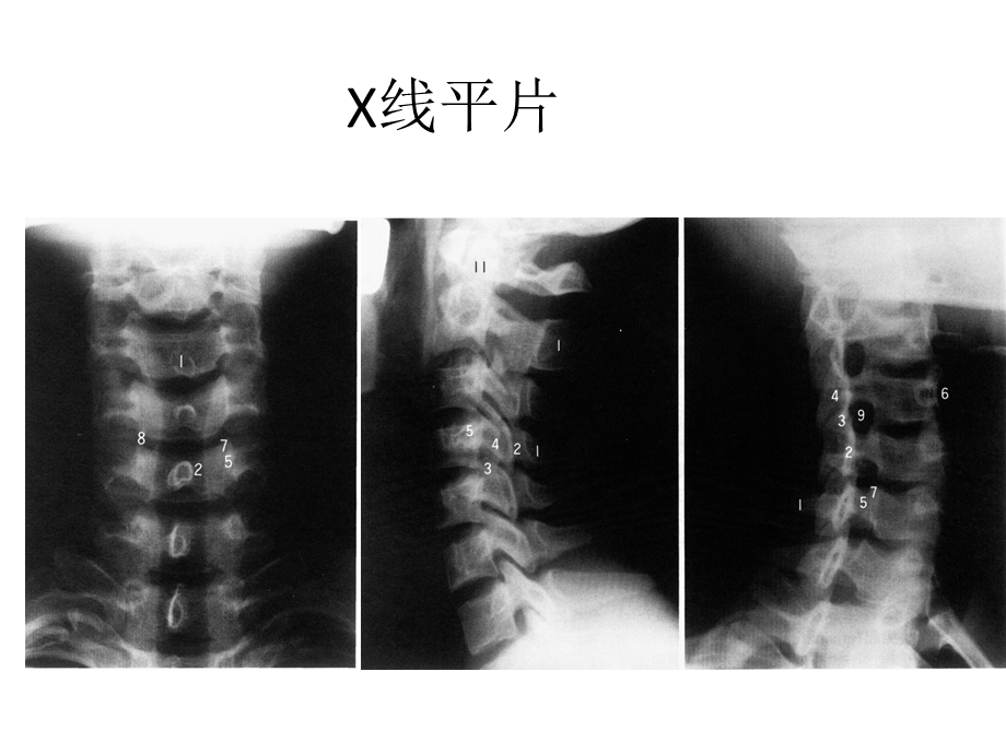 脊柱解剖精选文档.ppt_第1页