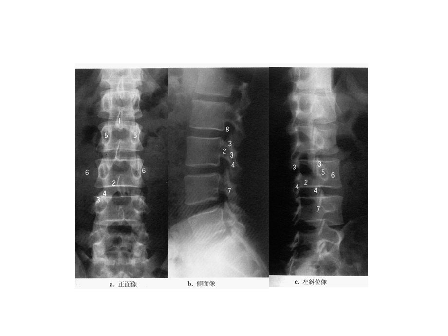 脊柱解剖精选文档.ppt_第3页