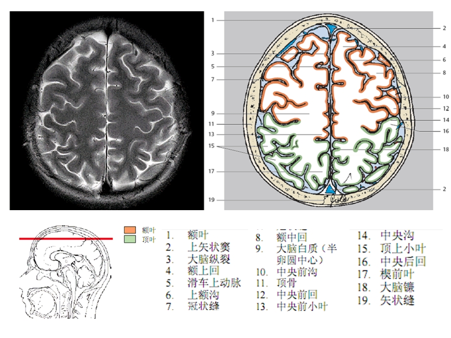 头颈CTMRI解剖图解系列2.ppt_第3页