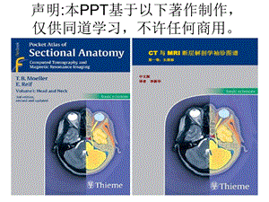 头颈CTMRI解剖图解系列2.ppt