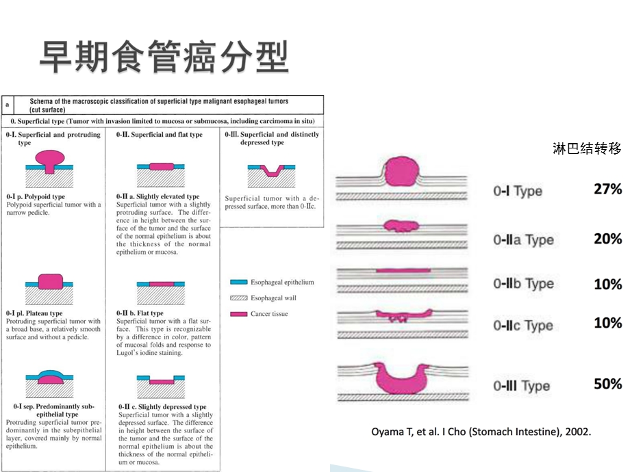 NBI放大在食管早癌诊断中的应用进展.ppt_第3页