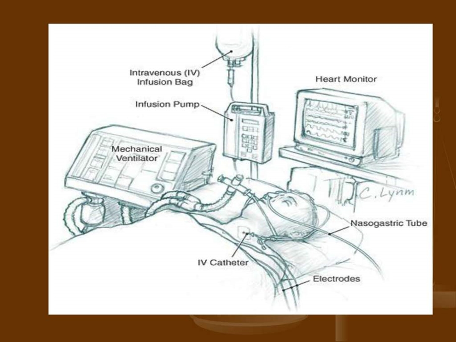 呼吸机基本模式与参数设置图文.ppt.ppt_第2页