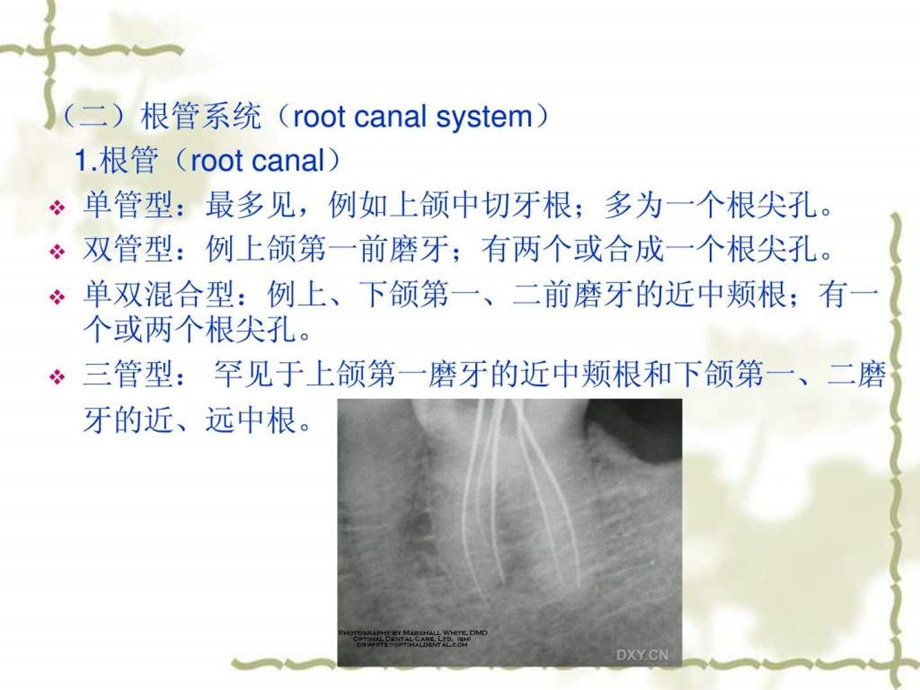 3髓腔图文.ppt14.ppt_第3页