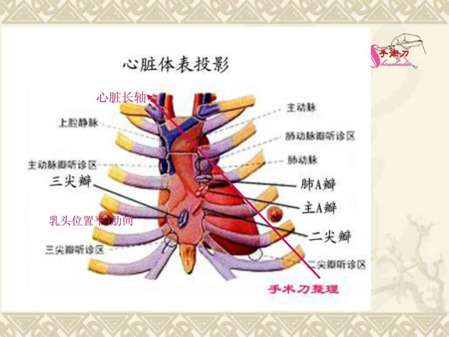 超声心动图常用切面的打法图解.ppt.ppt_第3页