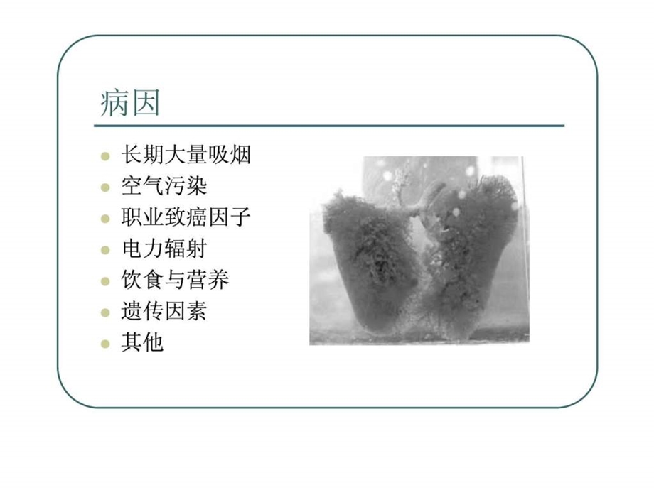 肺癌病理分型图文.ppt.ppt_第3页