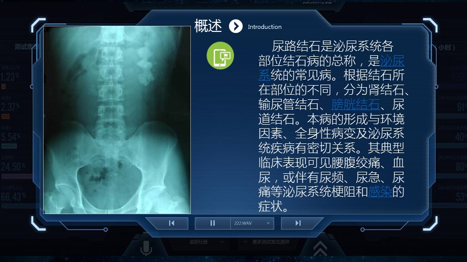 泌尿系结石的治疗文档资料.pptx_第3页