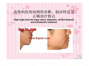 高角和低角病例的诊断临床特征及正畸治疗特点图文.ppt.ppt