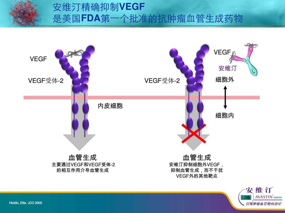 肺癌加腹水图文.ppt.ppt_第2页