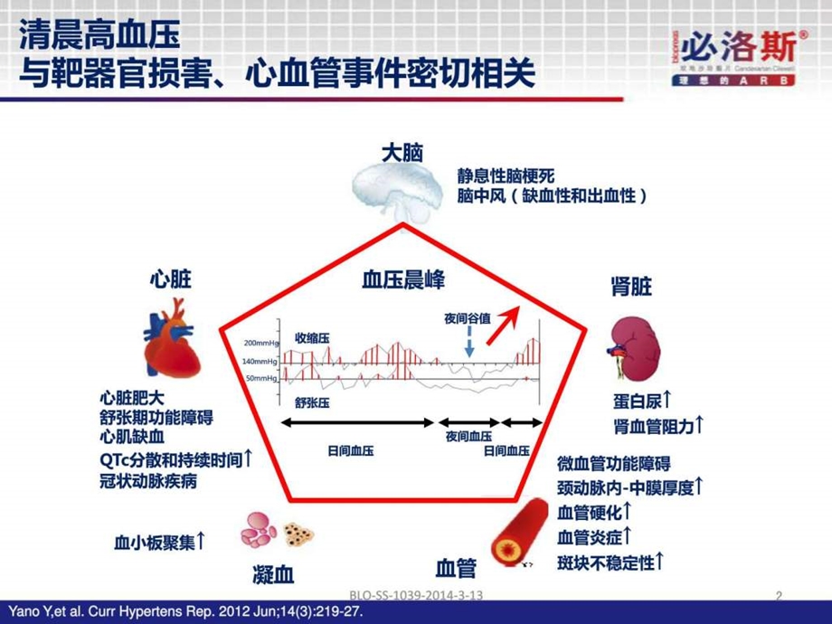 必洛斯fy科室推广幻灯强效降压始于晨图文29.ppt_第2页