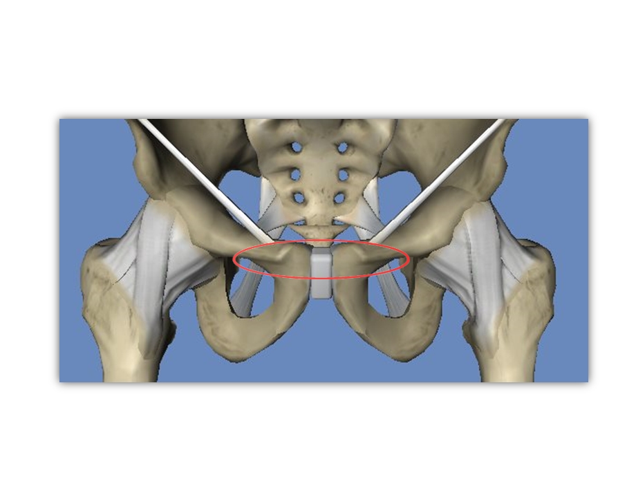 人体骨盆的结构介绍0806文档资料.pptx_第3页