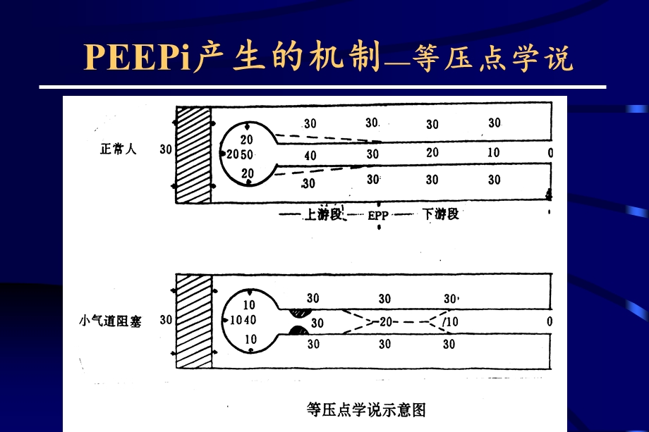 慢性阻塞性肺疾病的机械通气ppt课件.ppt_第3页