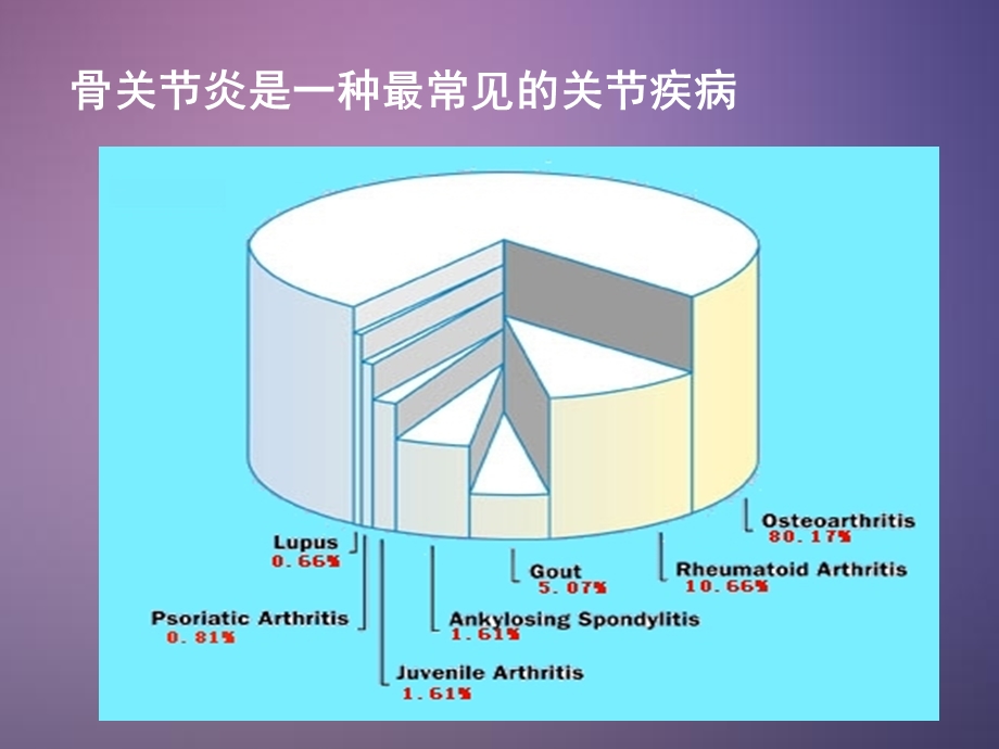 骨关节炎ppt课件精选文档.ppt_第1页