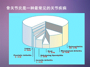 骨关节炎ppt课件精选文档.ppt