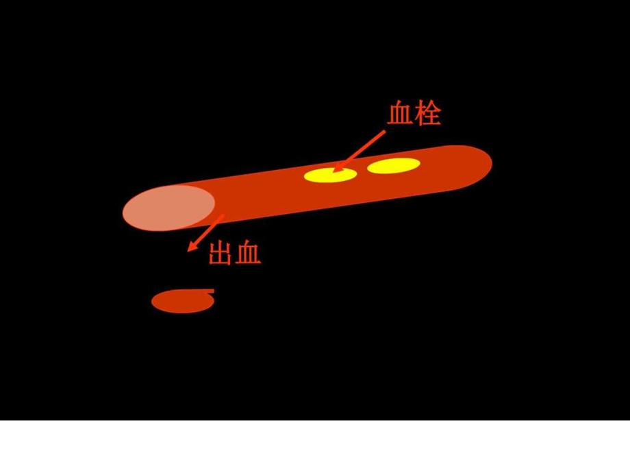 止血与血栓检测图文.ppt.ppt_第2页