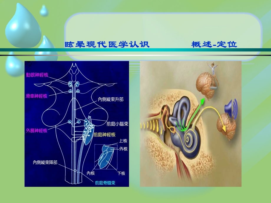 眩晕的诊断与治疗课件文档资料.ppt_第3页