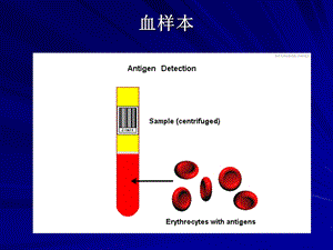 ABO血型和MN血型鉴定.ppt