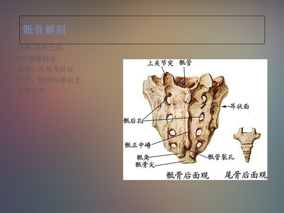 骶骨肿瘤ppt课件PPT文档.ppt_第1页