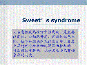 sweets综合征ppt课件.ppt