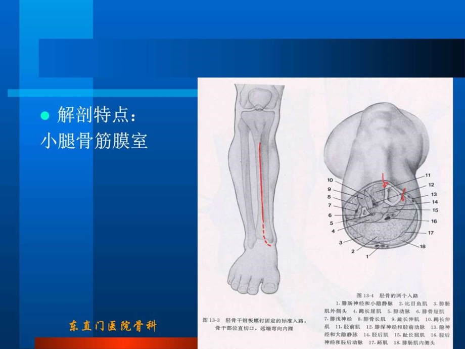 胫腓骨骨折图文.ppt.ppt_第3页