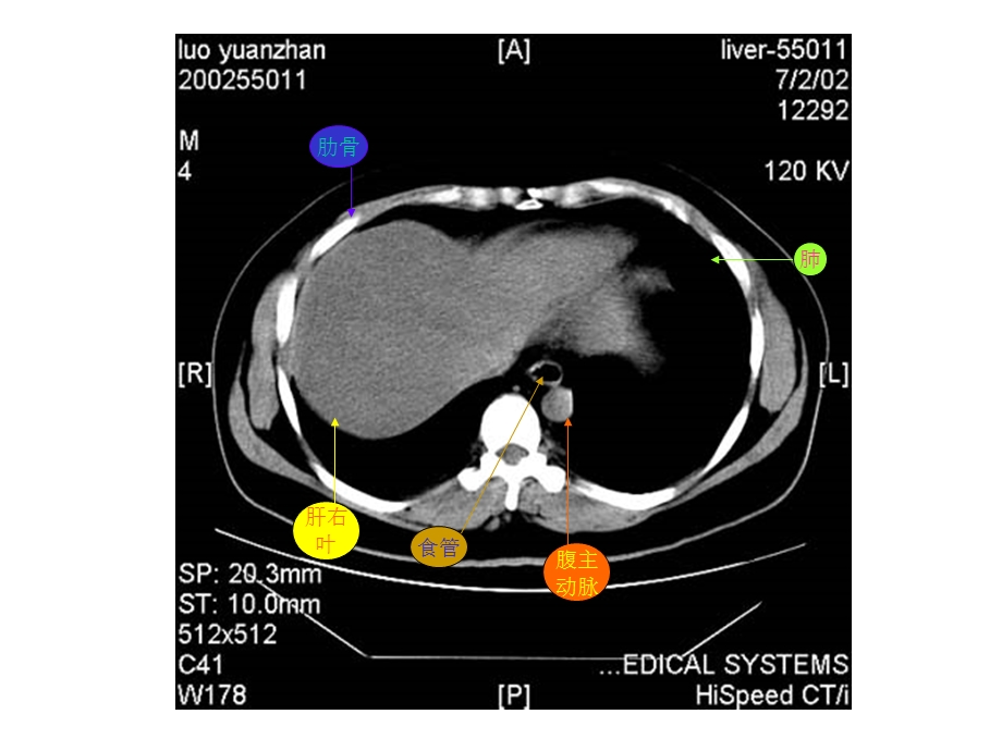 【共享】超好的腹部CT学习图片及PPT资料PPT文档.ppt_第1页