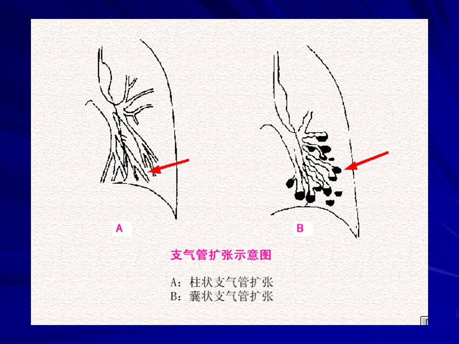 肺与纵隔疾病.ppt_第2页