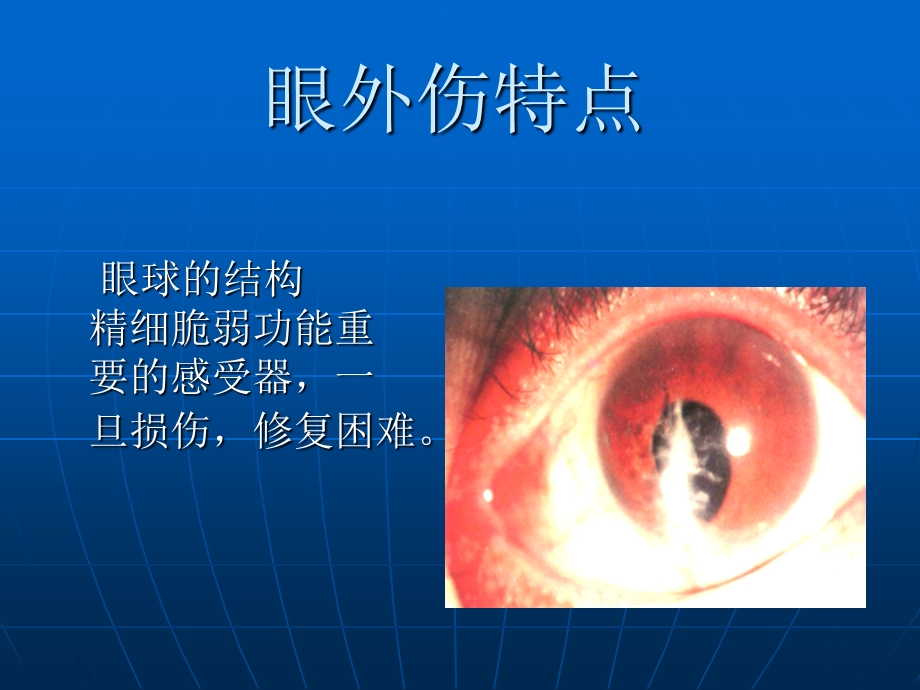 眼外伤本科临床文档资料.ppt_第2页