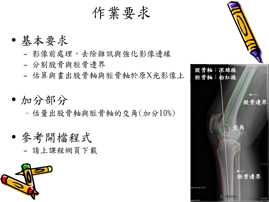 醫療影像分析.ppt_第3页