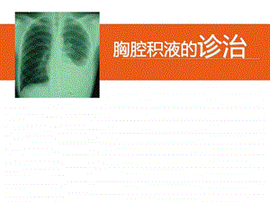 胸腔积液图文1587655817.ppt.ppt