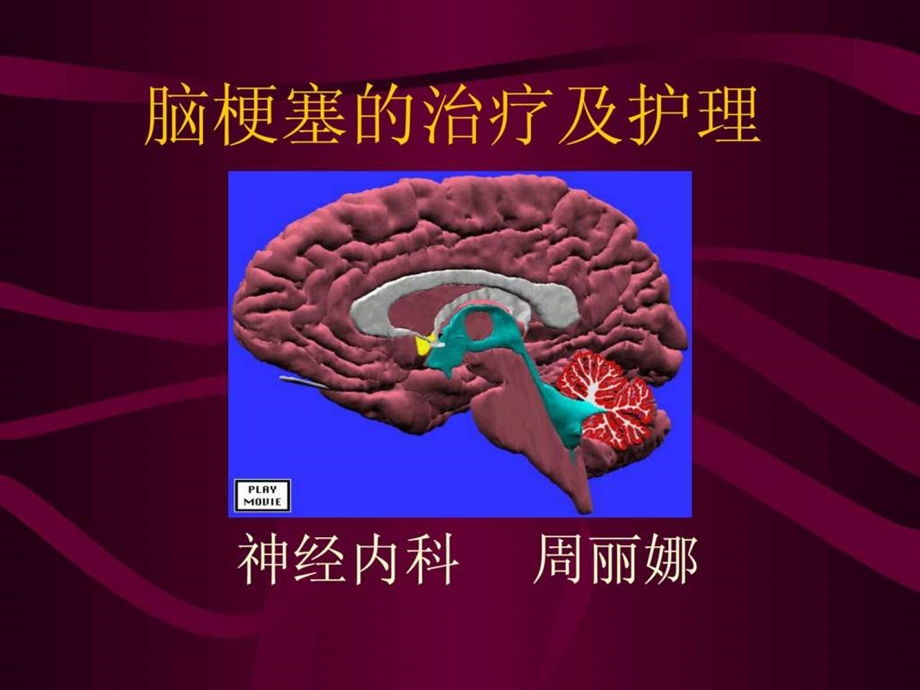 脑梗塞护理.ppt_第1页