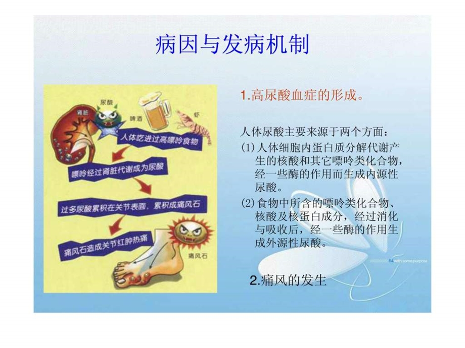 痛风患者的护理图文.ppt_第3页