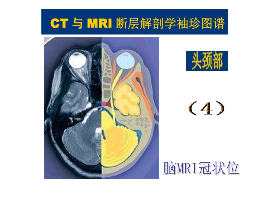 头颈CTMRI解剖图解系列4.ppt_第2页