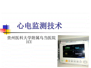 心电监测技术图文.ppt.ppt