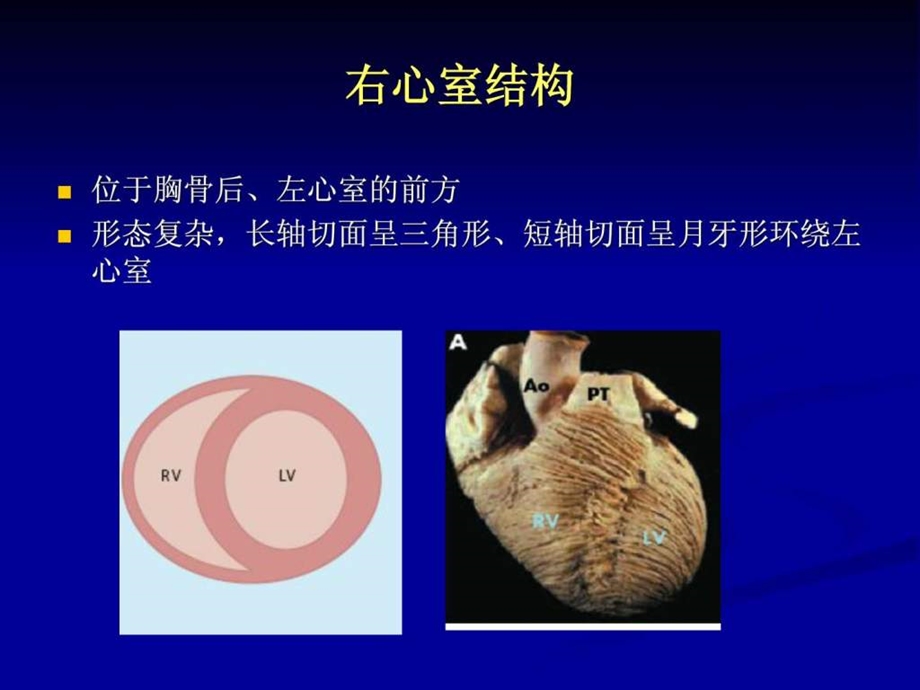 超声心动图评价右心功能.ppt.ppt_第3页