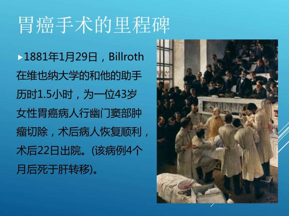 胃癌手术史图文.ppt.ppt_第3页