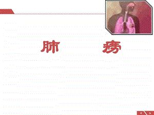 肺痨ppt课件图文.ppt.ppt