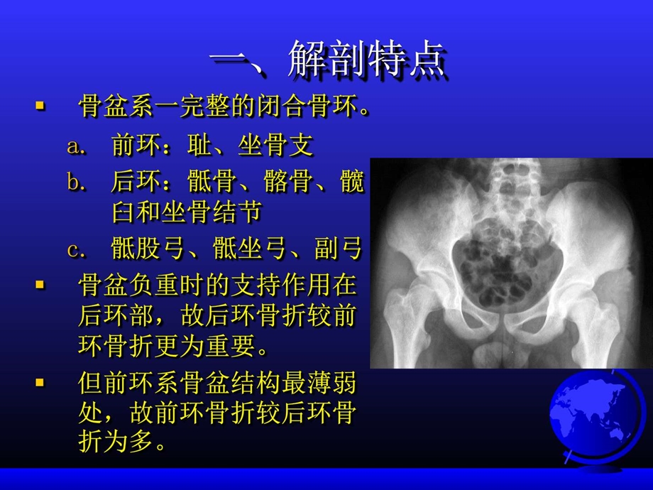 骨盆骨折临床医学医药卫生专业资料.ppt.ppt_第3页