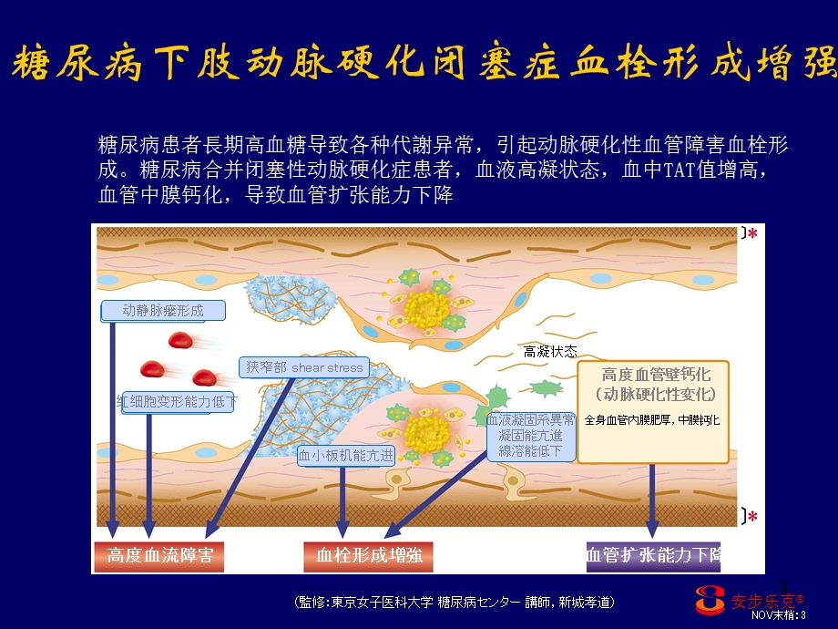 安步乐克对糖尿病下肢血管病变的治疗作用.ppt_第3页