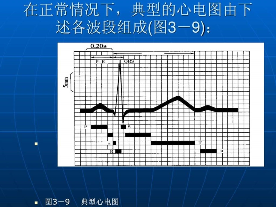 心肌细胞动作电位与心电图的关系.ppt.ppt_第3页