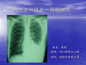 胸腔积液病例分析.ppt.ppt
