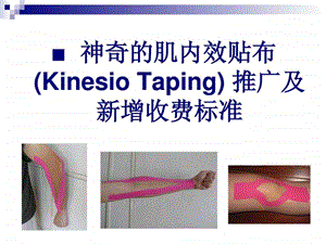 神奇的肌内效贴布KinesioTaping推广及新增收费标准.ppt.ppt