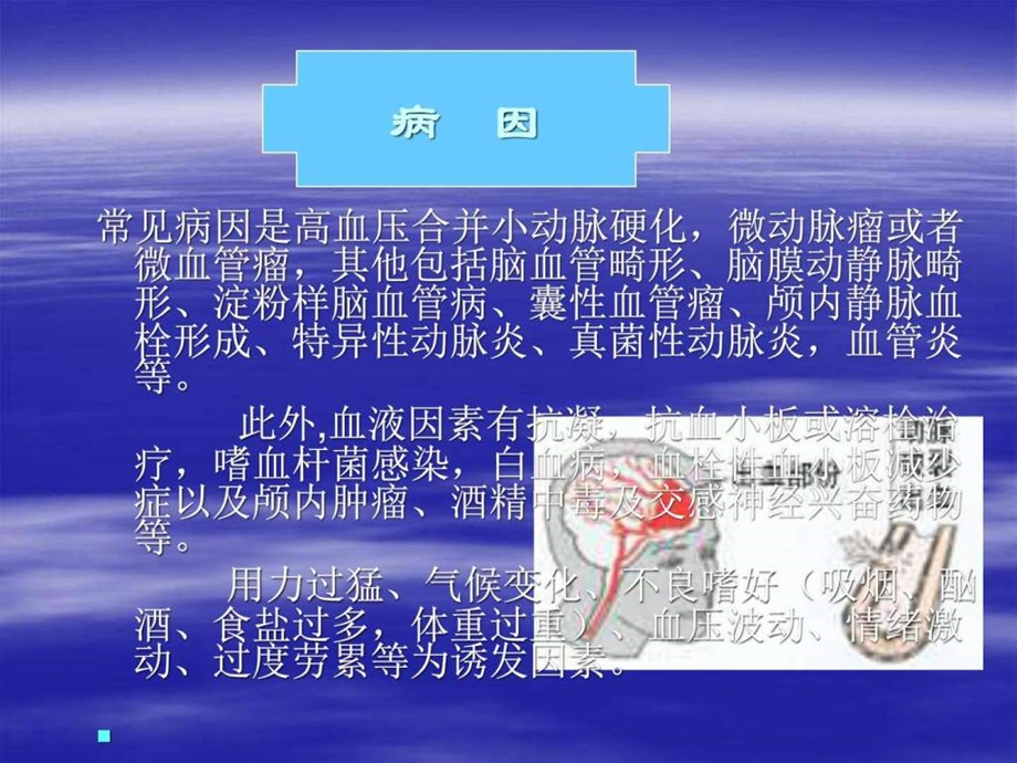 脑出血护理图文1509491415.ppt.ppt_第3页