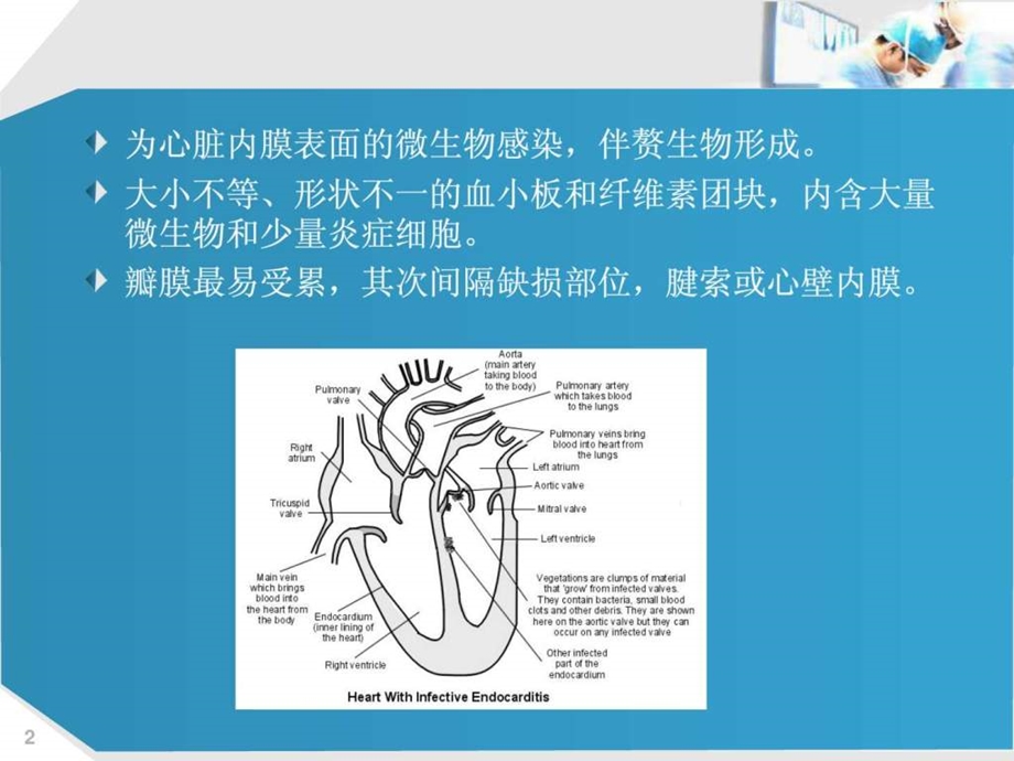 课件感染性心内膜炎.ppt_第2页