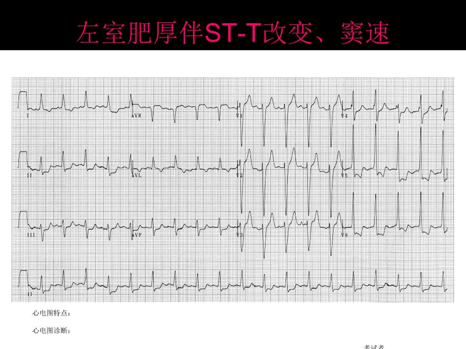 心电图考试完整.ppt_第2页