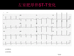 心电图考试完整.ppt