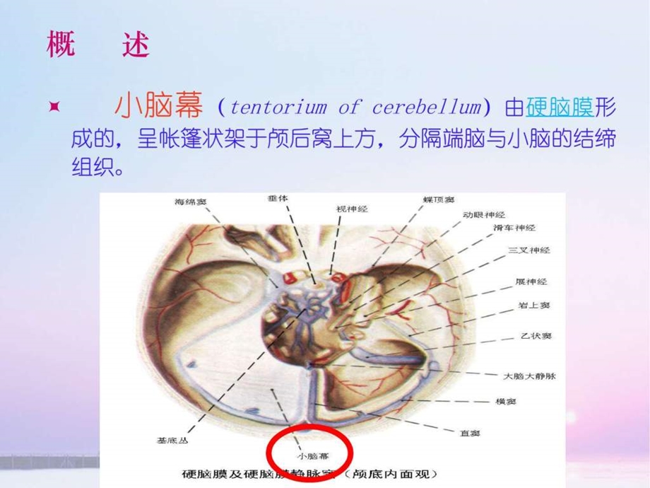 幕下肿瘤的护理图文.ppt_第3页