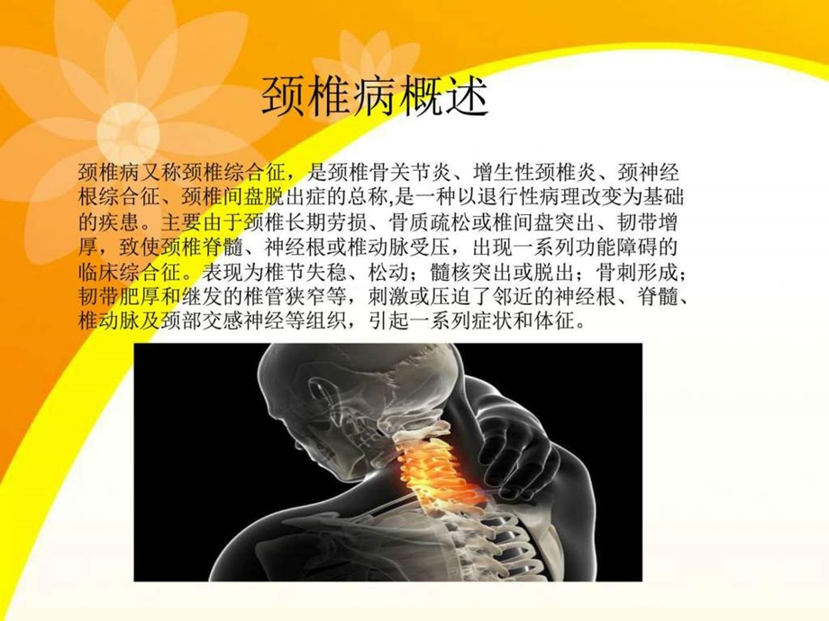 10颈椎病的护理图文.ppt.ppt_第2页