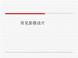 常见经典影像读片图文.ppt.ppt